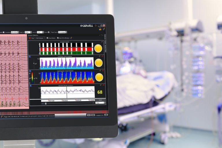 EEG Machine | EEG Equipment | Portable EEG | Brain Monitoring